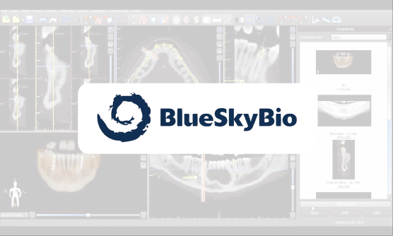 Certificado em Blue Sky