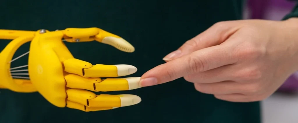 Como a impressão 3D auxilia na criação de próteses acessíveis